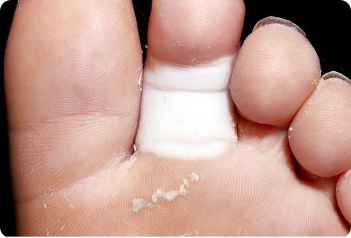 Causas da fratura dos dedos do pé