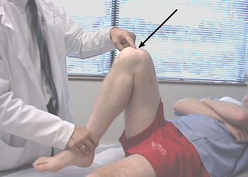 A dor no joelho durante a flexão é a razão mais comum pela qual as pessoas visitam os médicos do trauma. 