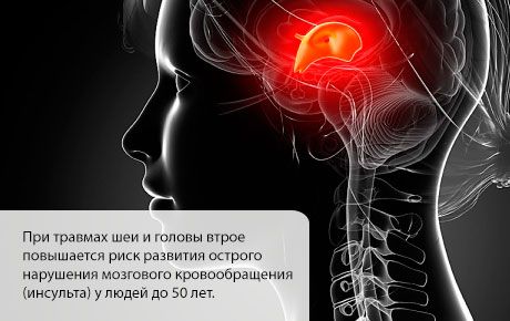 A probabilidade de um acidente vascular cerebral aumentar nos primeiros meses após uma lesão na cabeça ou no pescoço