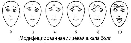 Escala de dor facial modificada
